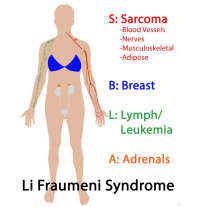 Ailesel Kanserler (Li-Fraumeni Sendromu ) Genetiği