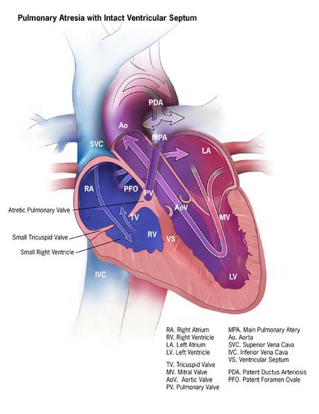 Ulusal Kalp, Akciğer ve Kan Enstitüsü - Vikipedi