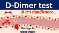 D-dimer testi ve COVID-19