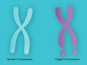Fragile X İlişkili Primer Over Yetmezliği (FXPOI) Genetiği (Erken yumurtalık yetmezliği)